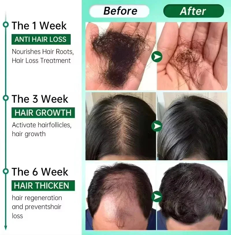 Fast Hair Growth Serum Spray