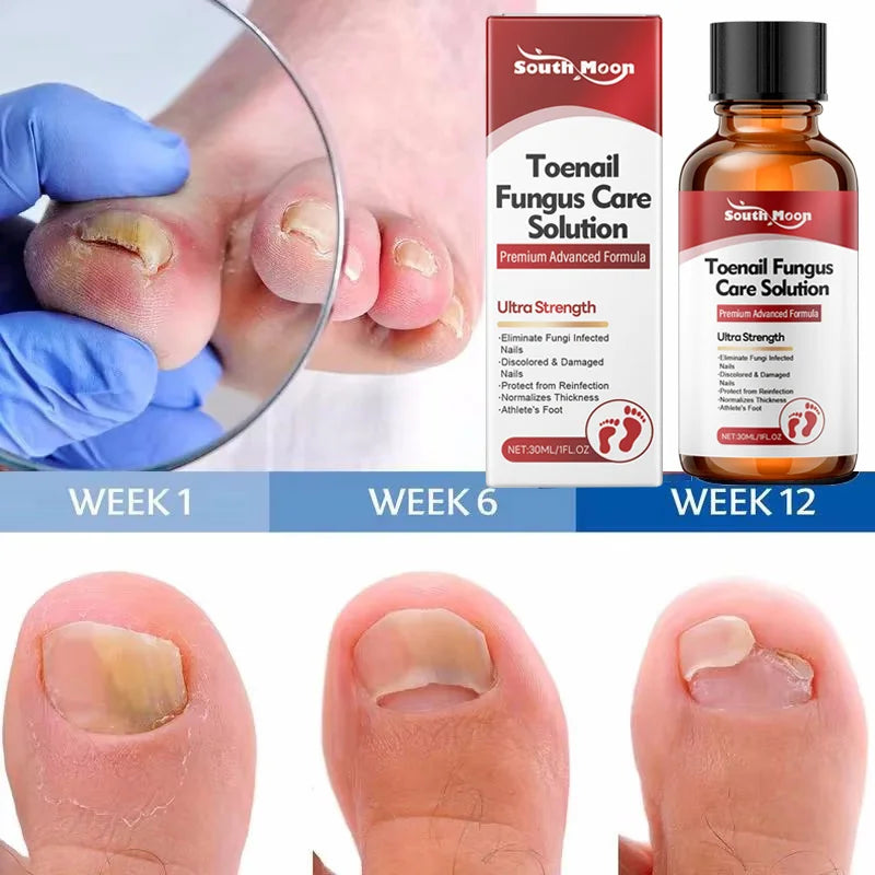 Advanced Fungal Nail Treatment Serum