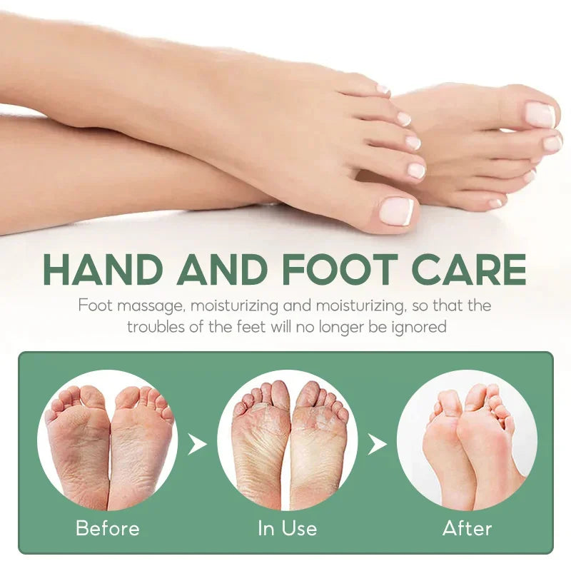 Herbal Anti-Crack Foot Cream Spray