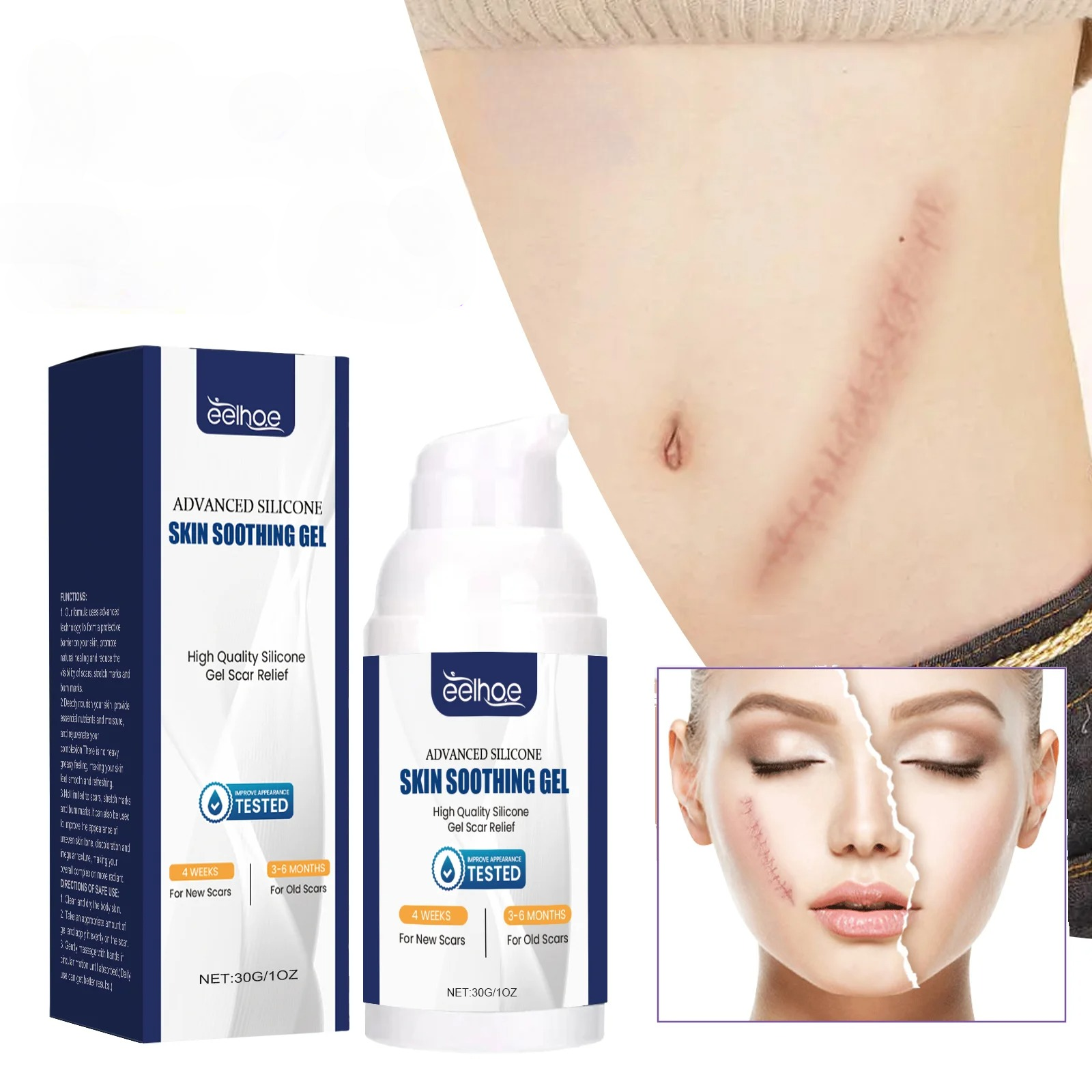 Advanced Silicone Scar Gel