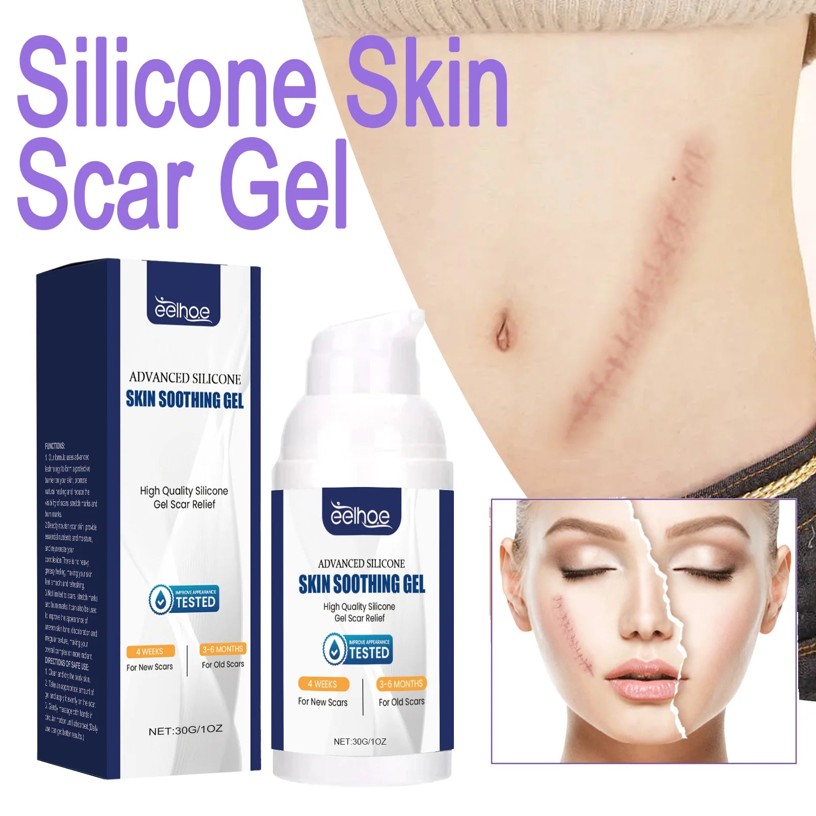 Advanced Silicone Scar Gel