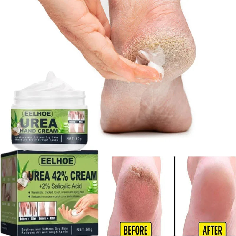 Cracked Heel Repair Foot Cream