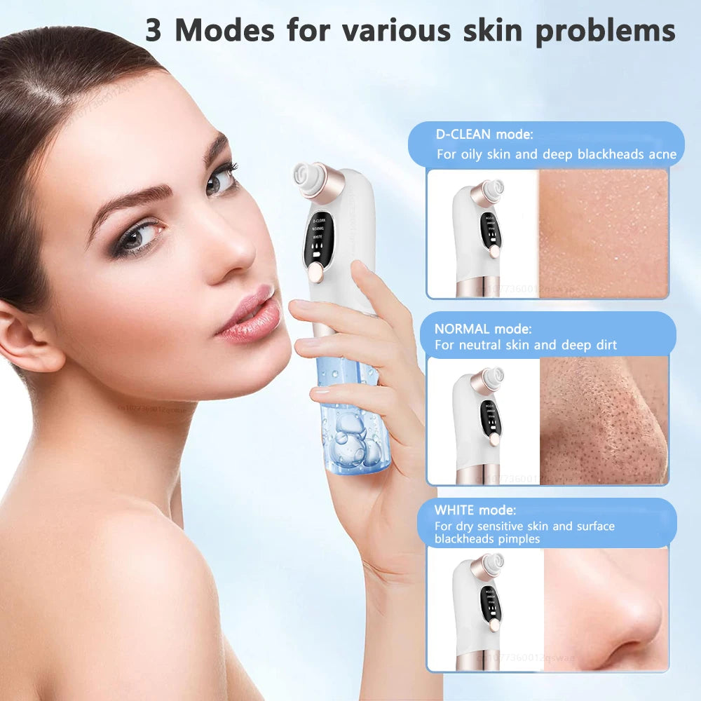 Rechargeable Blackhead Remover Vacuum