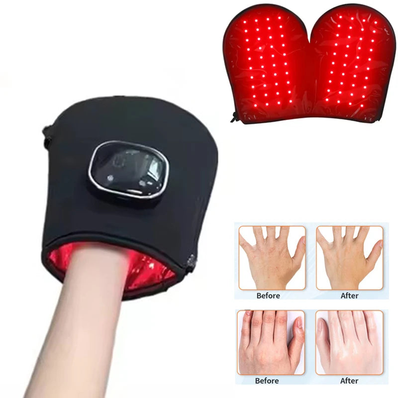 Rechargeable Red and Infrared Light Therapy Glove