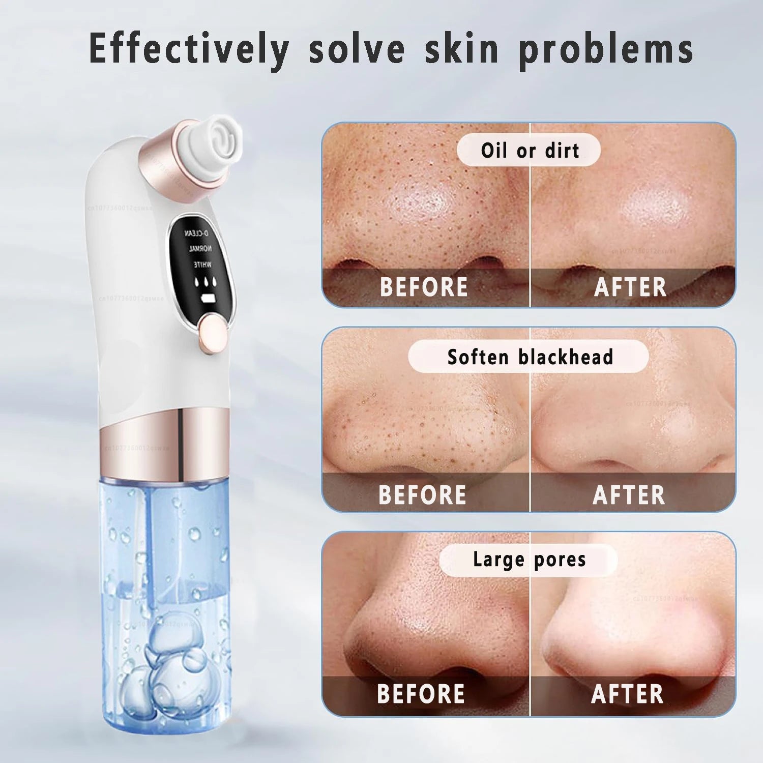 Rechargeable Blackhead Remover Vacuum
