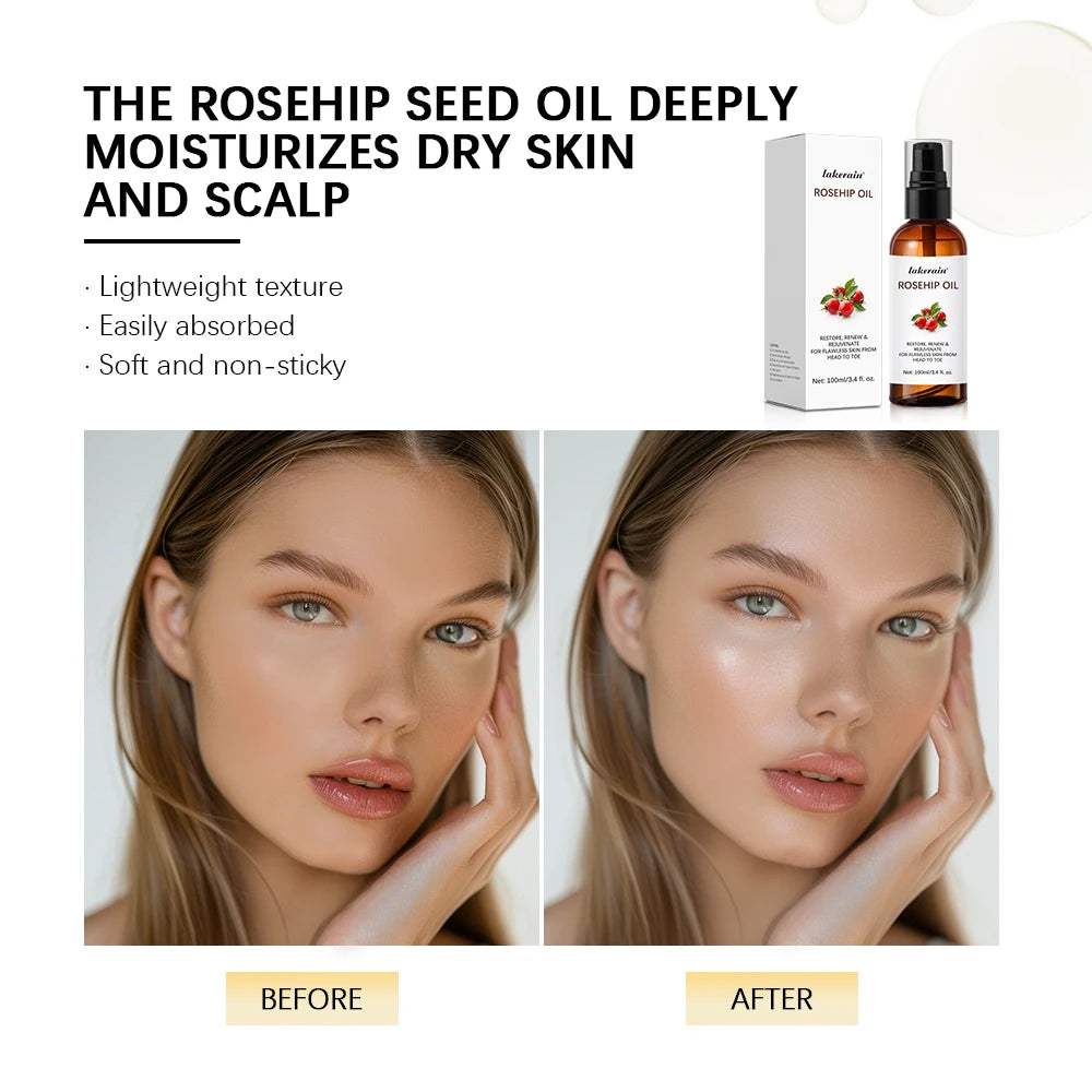 Organic Rosehip Seed Face Oil