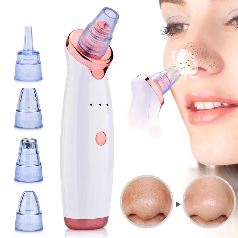 USB Rechargeable Blackhead Vacuum Remover