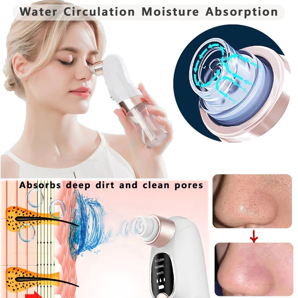 Rechargeable Blackhead Remover Vacuum
