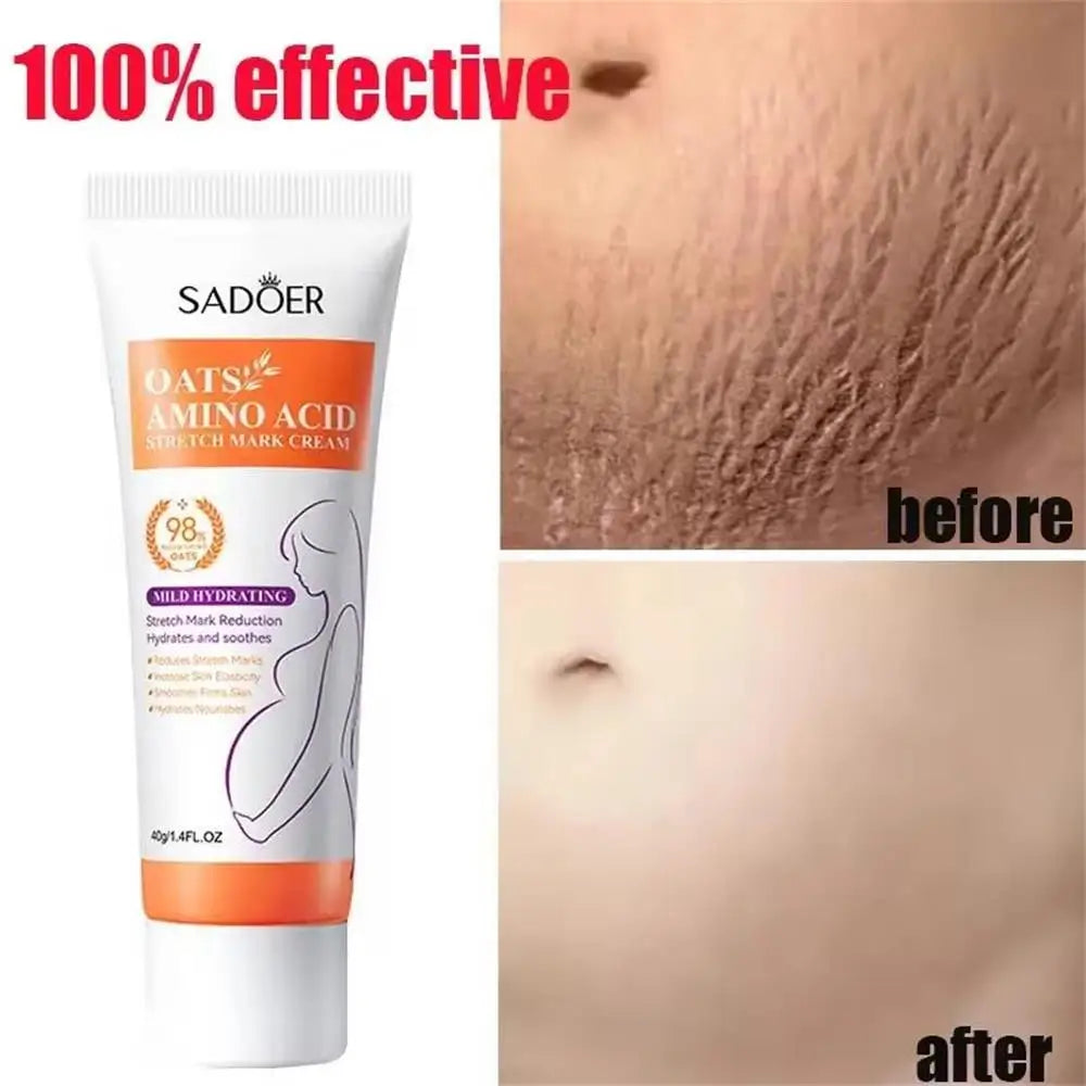 Advanced Stretch Mark Removal Oil