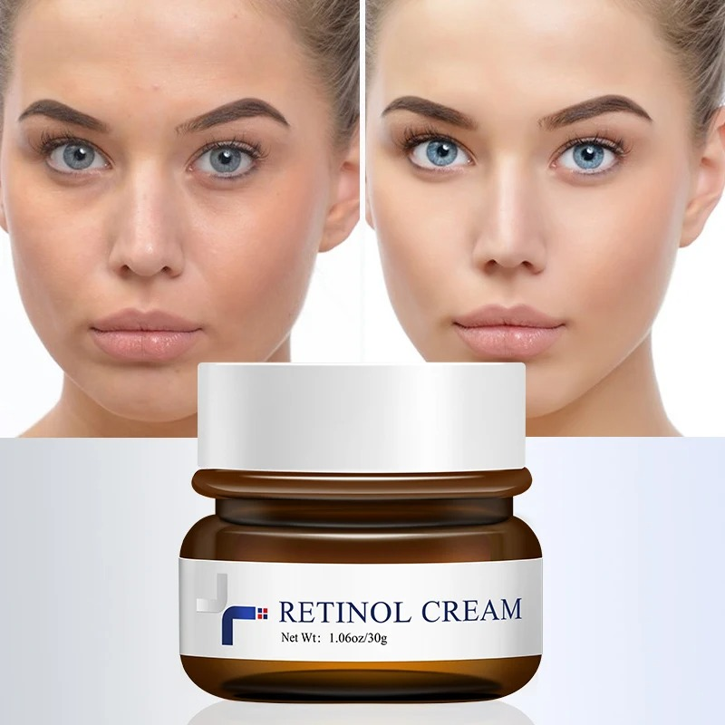 Retinol Anti-Wrinkle Moisturizing Cream