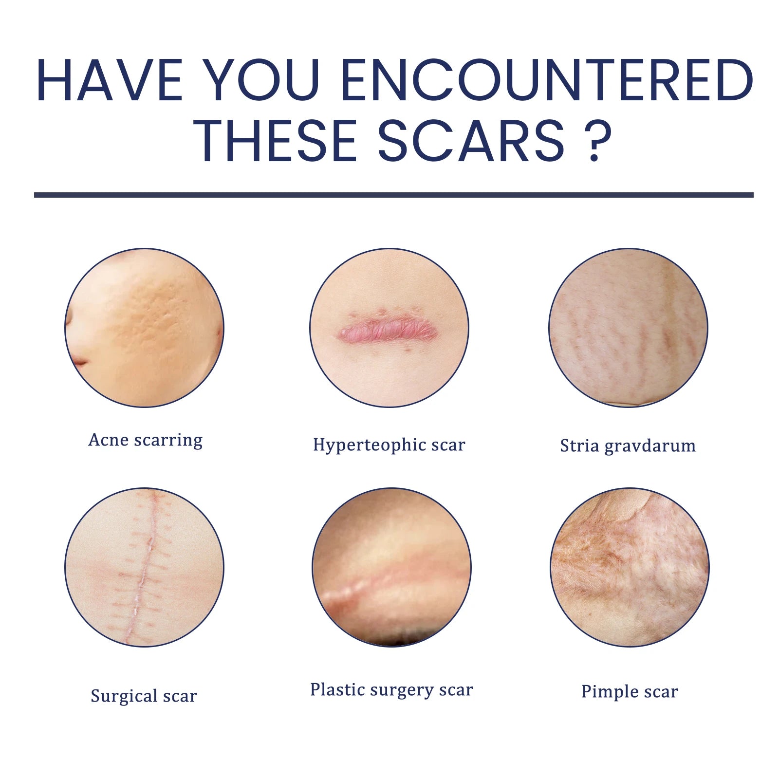 Advanced Silicone Scar Gel