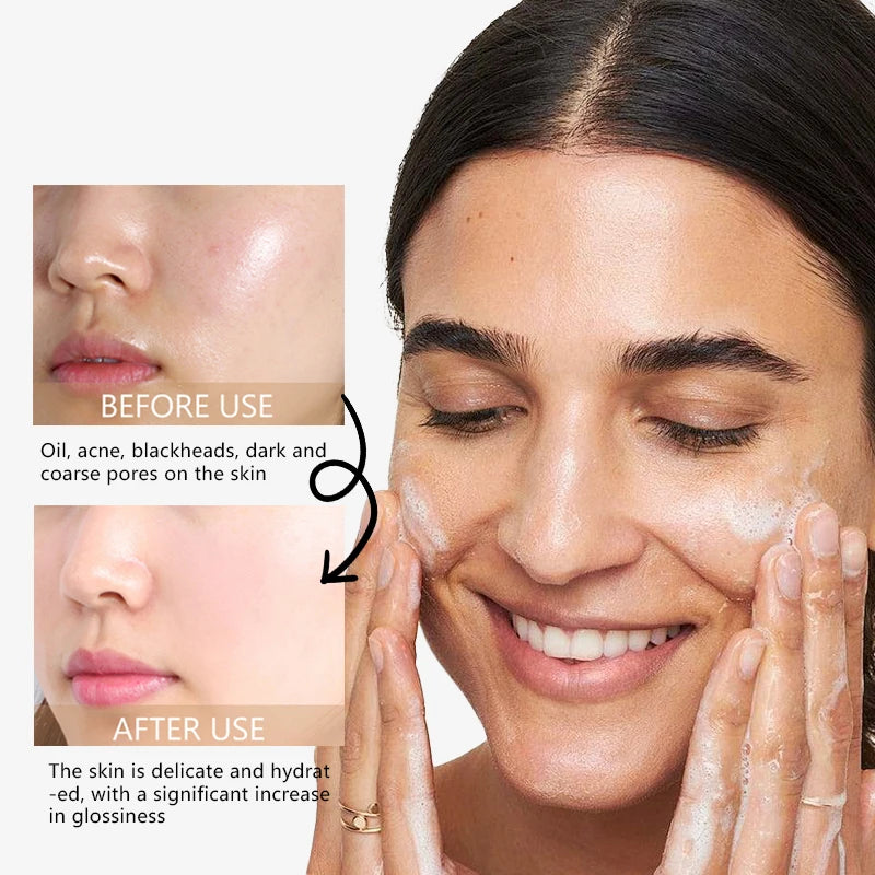 Whitening Facial Foam Exfoliating Deep Remove Cleanser