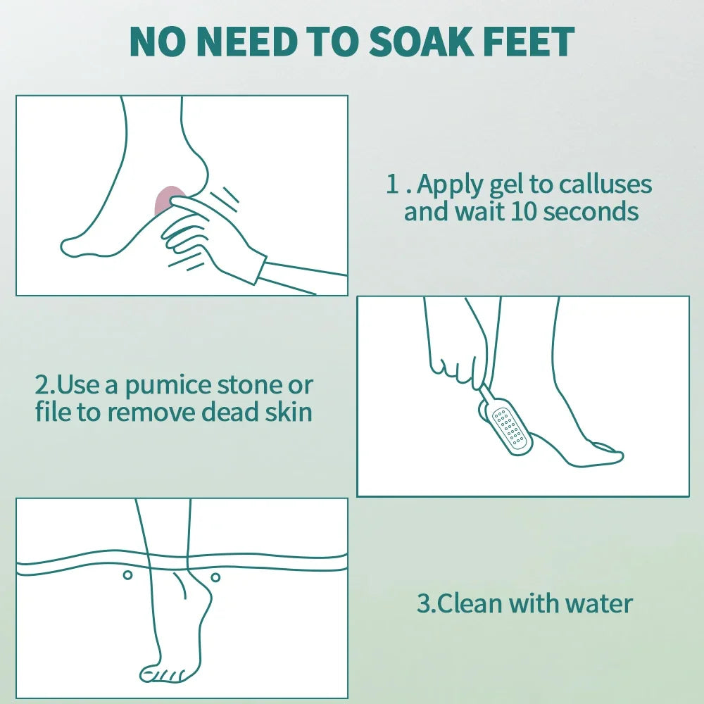 Callus Softener Gel and Foot File Set