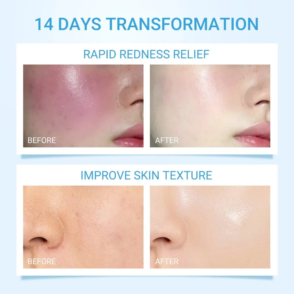 Ceramide Barrier Strength Serum