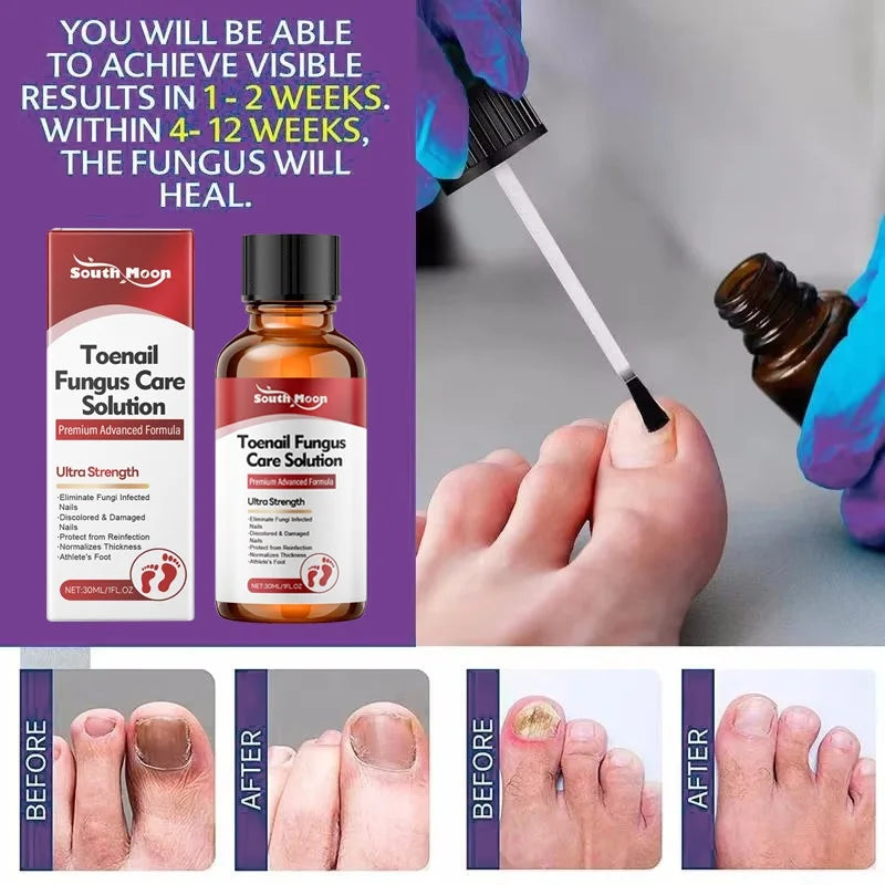 Advanced Fungal Nail Treatment Serum