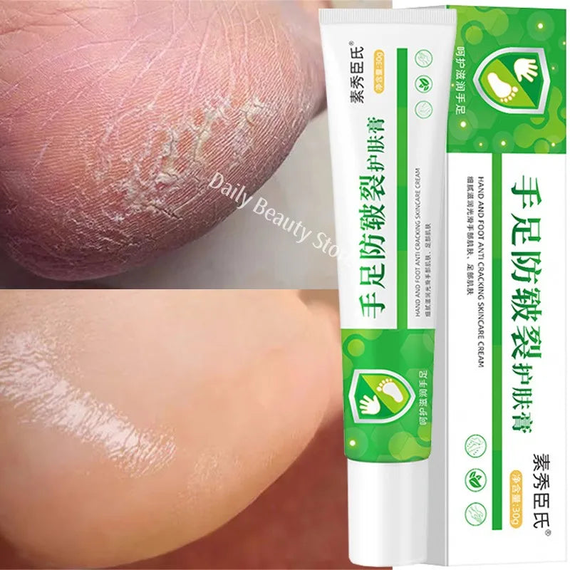 Herbal Anti-Crack Foot Cream Spray